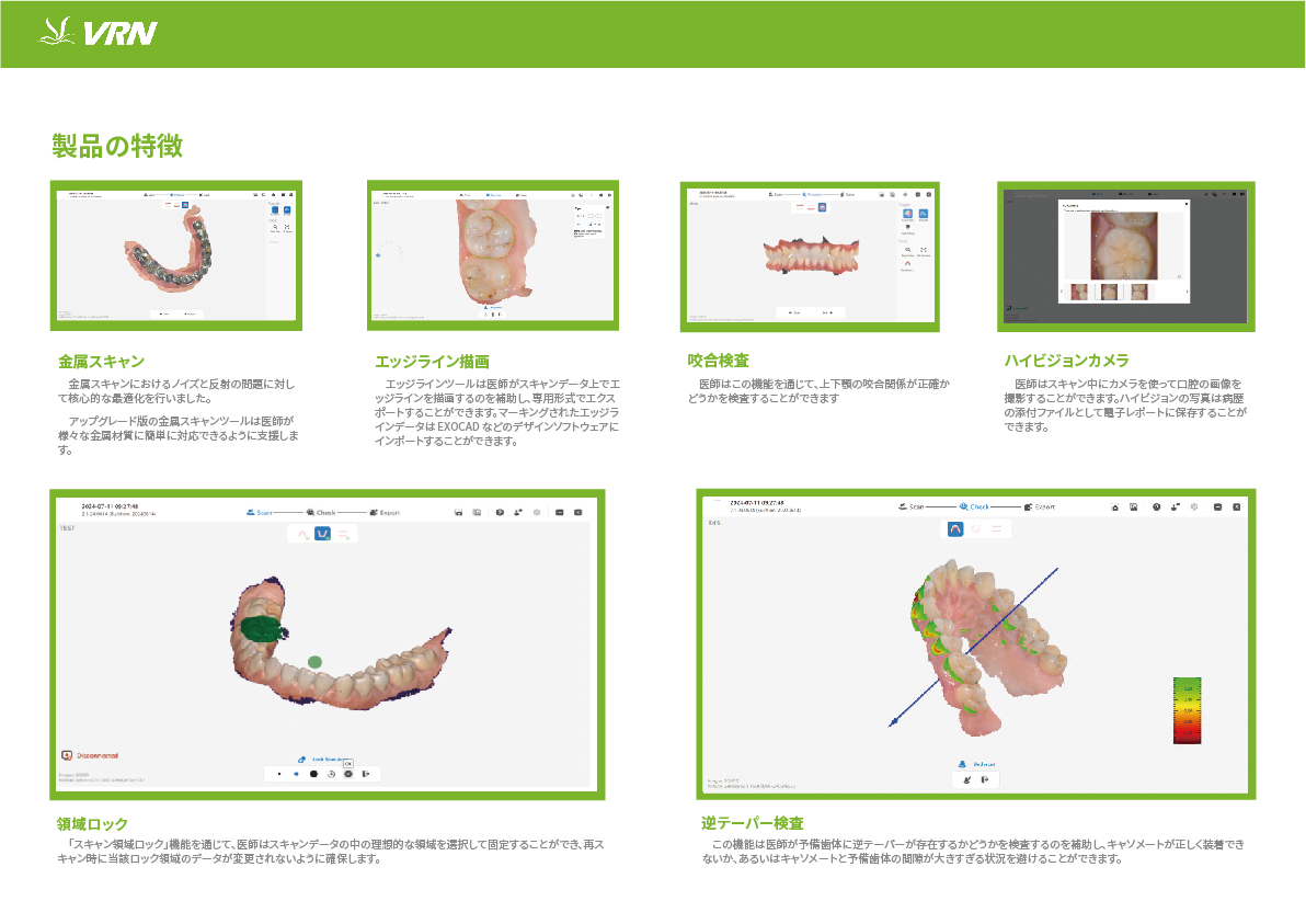 口腔掃描儀-04.jpg